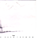To detect hPDGF-BB by Western Blot analysis this antibody can be used at a concentration of 0.1-0.2 ug/ml. Used in conjunction with compatible secondary reagents the detection limit for recombinant hPDGF-BB is 1.5-3.0 ng/lane, under either reducing or non-reducing conditions.