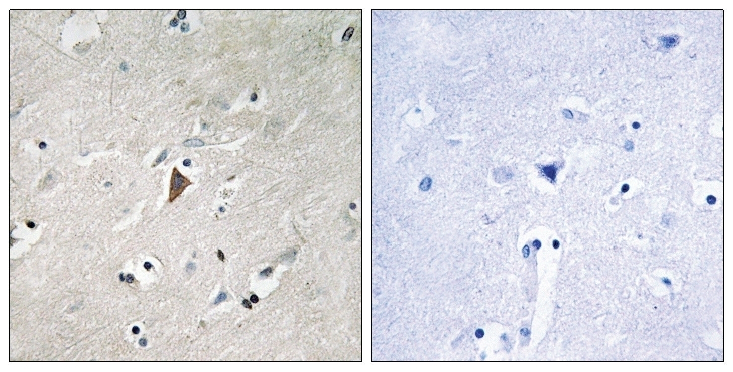 PDK1 (phospho Tyr9) Antibody