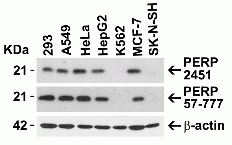 PERP Antibody