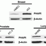 <strong>Figure 9  Overexpression of PHAPI in Breast Cancer Cells (Schafer et al., 2006) </strong><br>Western blot analysis with anti-PHAPI antibodies was performed for PHAPI in human cell lines from breast, prostate and lung.  PHAPI was overexpressed in breast cancer cells when compared with normal cells (HMEC) whereas  there were no significant differences in PHAPI expression in normal and cancer cells of either prostate or lung origin.