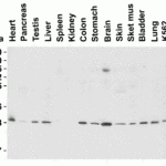 <strong>Figure 4 Western Blot Validation in Mouse Tissues</strong><br>Loading: 15 μg of lysates per lane.Antibodies: PHAP I  3151 (1 μg/mL), 1h incubation at RT in 5% NFDM/TBST.Secondary: Goat anti-rabbit IgG HRP conjugate at 1:10000 dilution.