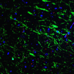 Immunofluorescence of PINK1 in mouse brain tissue with PINK1 Antibody at 20 μg/mL. <br><br>Green: PINK1 antibody (7859) <br> Red: Phylloidin staining<br> Blue: DAPI staining