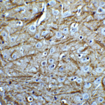 Immunohistochemistry of PINK1 in mouse brain tissue with PINK1 Antibody at 5 μg/mL.