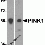 Western blot analysis of PINK1 in (A) mouse and (B) rat spleen tissue lysate with PINK1 antibody at 1 μg/mL.