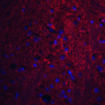 Immunofluorescence of PION in mouse brain tissue with PION antibody at 20 μg/mL.<br><br>Red: PION Antibody (6161) <br> Blue: DAPI staining