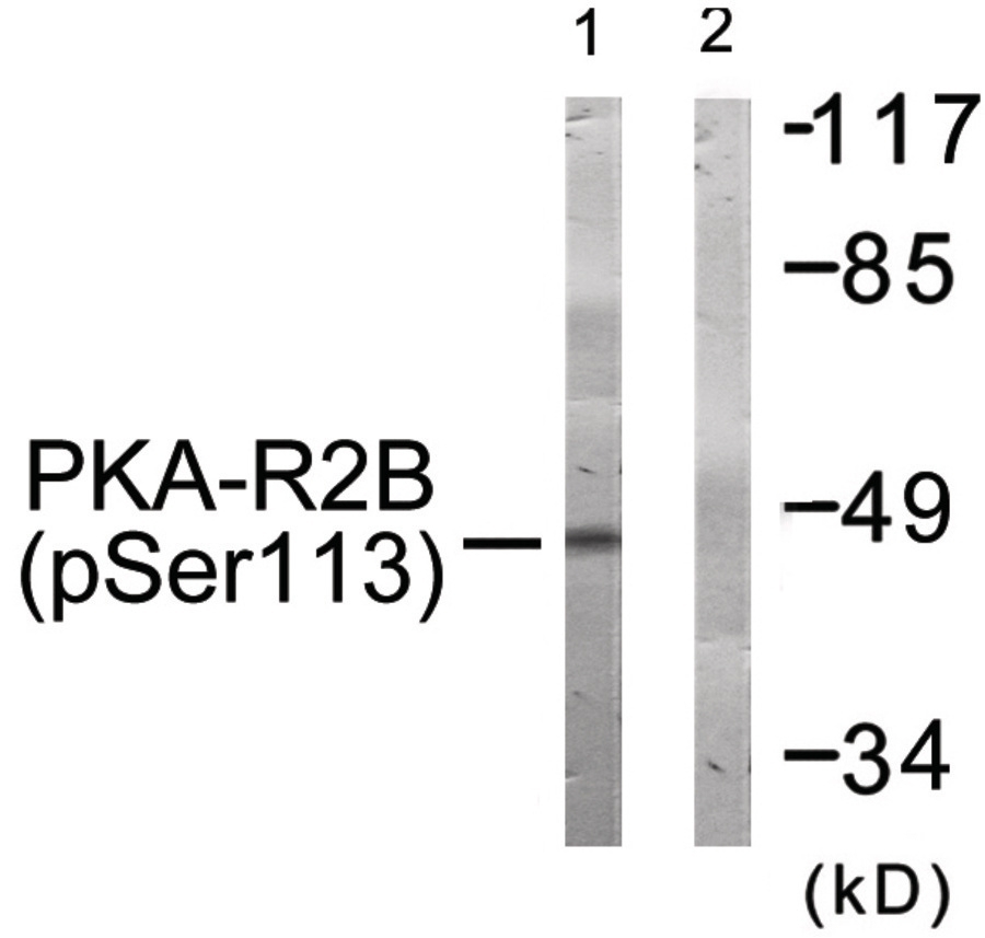 PKA-R2beta (phospho Ser113) Antibody
