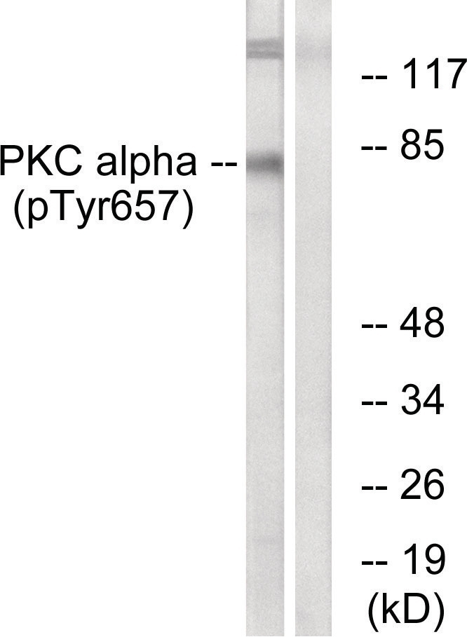 PKC alpha (phospho Tyr658) Antibody