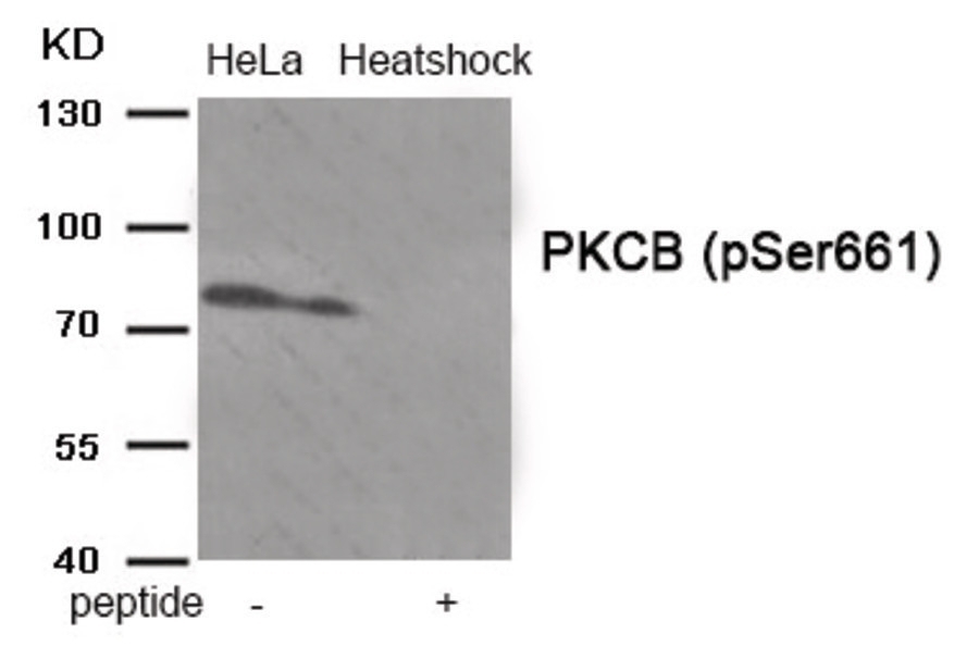 PKCB (phospho Ser661) Antibody