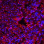 <strong>Figure 5 Immunofluorescence Validation of PKR in Mouse Lung</strong><br>Immunofluorescent analysis of 4% paraformaldehyde-fixed mouse lung tissue labeling PKR with 3947 at 20 μg/mL, followed by goat anti-rabbit IgG secondary antibody at 1/500 dilution (red) and DAPI staining (blue).
