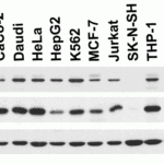 <strong>Figure 2 Independent Antibody Validation (IAV) via Protein Expression Profile in Cell Lines</strong><br>Loading: 15 μg of lysates per lane.Antibodies: PKR 3947 (1 μg/mL), PKR 3949 (1 μg/mL, and beta-actin (1 μg/mL), 1h incubation at RT in 5% NFDM/TBST.Secondary: Goat anti-rabbit IgG HRP conjugate at 1:10000 dilution.