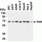 <strong>Figure 3 Western Blot Validation of PKR in Human Cell Lines </strong><br>Loading: 15 μg of lysates per lane.Antibodies: PKR 3949 (1 μg/mL), 1h incubation at RT in 5% NFDM/TBST.Secondary: Goat anti-rabbit IgG HRP conjugate at 1:10000 dilution.
