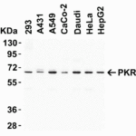 <strong>Figure 1 Western Blot Validation of PKR in Human Cell Lines </strong><br>Loading: 15 μg of lysates per lane.Antibodies: PKR 3947 (1 μg/mL), 1h incubation at RT in 5% NFDM/TBST.Secondary: Goat anti-rabbit IgG HRP conjugate at 1:10000 dilution.