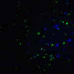 Immunofluorescence of PLAGL2 in rat brain tissue with PLAGL2 antibody at 20 μg/ml.<br><br>Green: PLAGL2 Antibody (7053) <br> Blue: DAPI staining