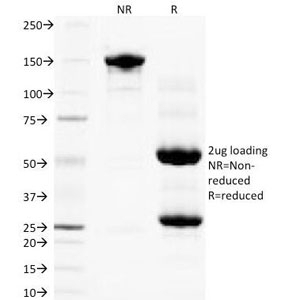 PLGF Antibody [PLGF94]