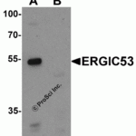 Western blot analysis of ERGIC53 in HL60 cell lysate with ERGIC53 antibody at 1 μg/mL in (A) the absence and (B) the presence of blocking buffer.