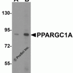 Western blot analysis of PPARGC1A expression in human liver tissue lysate with PPARGC1A antibody at (A) 1 and (B) 2 μg/ml.