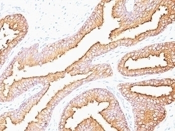 PSA Antibody [SPM352]