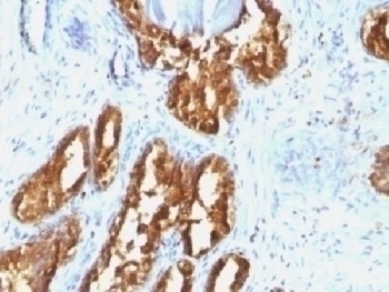 PSAP Antibody [ACCP/1338]