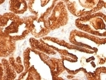 PSAP Antibody [SPM312]