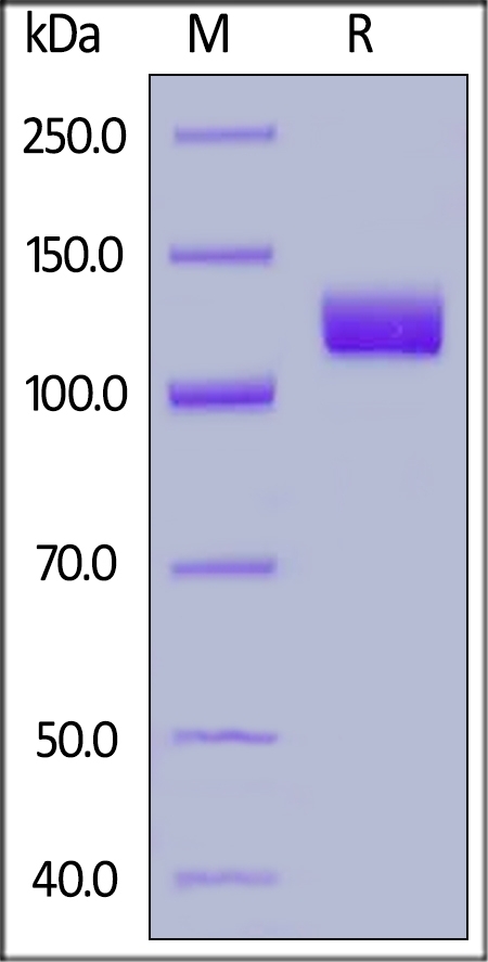 PSMA / FOLH1 Recombinant Protein