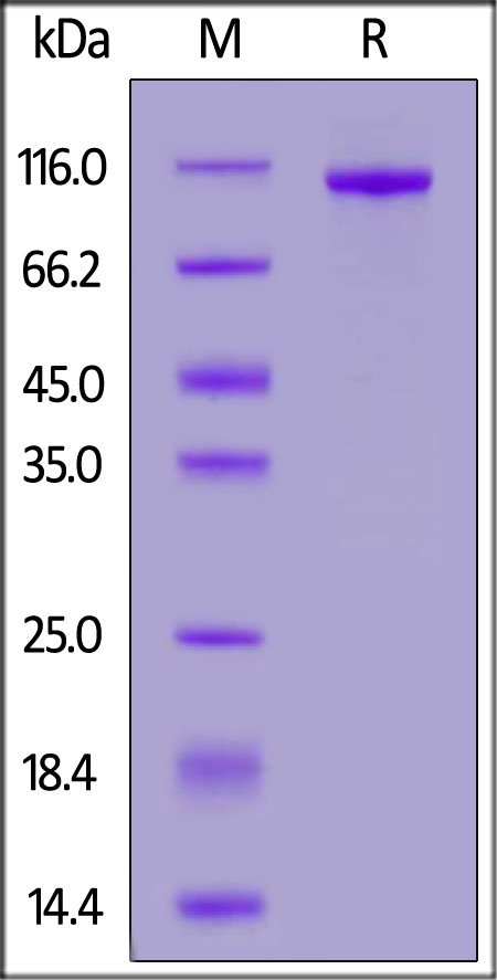 PTK7 / CCK4 Recombinant Protein