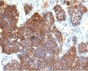 Parathyroid Hormone Antibody [PRTM1-3]