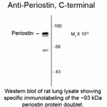 Western blot of rat lung lysate showing specific immnolabeling of the ~93 kDa periostin protein doublet.