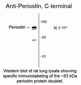 Periostin C-terminal Antibody