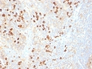 Plasma Cell Marker Antibody [SPM310]