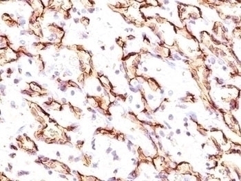 Podocalyxin Antibody [3D3]