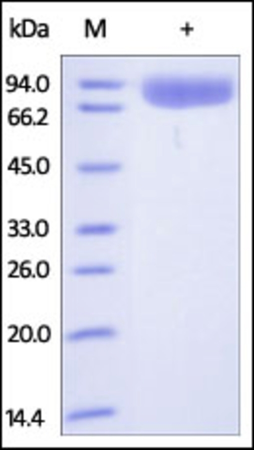 Poly Ig receptor Recombinant Protein