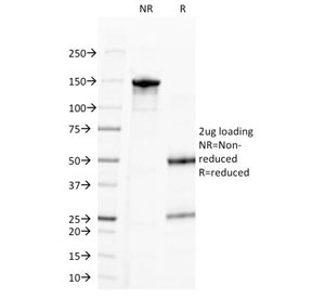Progesterone Antibody [6-5E-3F]