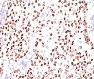 Progesterone Receptor Antibody [PGSR17]