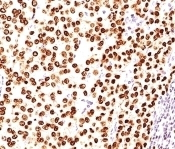 Progesterone Receptor Antibody [PR484]