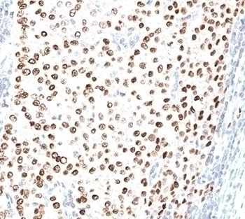 Progesterone Receptor Antibody [PR500]