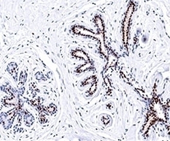 Progesterone Receptor Antibody [PR501]