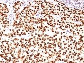 Progesterone Receptor Antibody [SPM566]