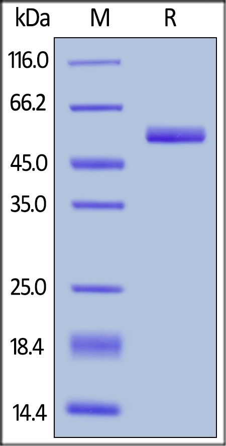 Prolactin / PRL Recombinant Protein