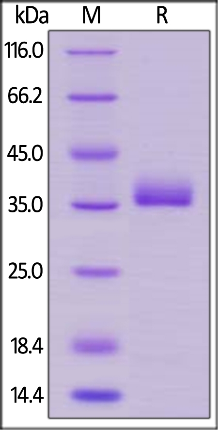 Prolactin R / PRLR Recombinant Protein