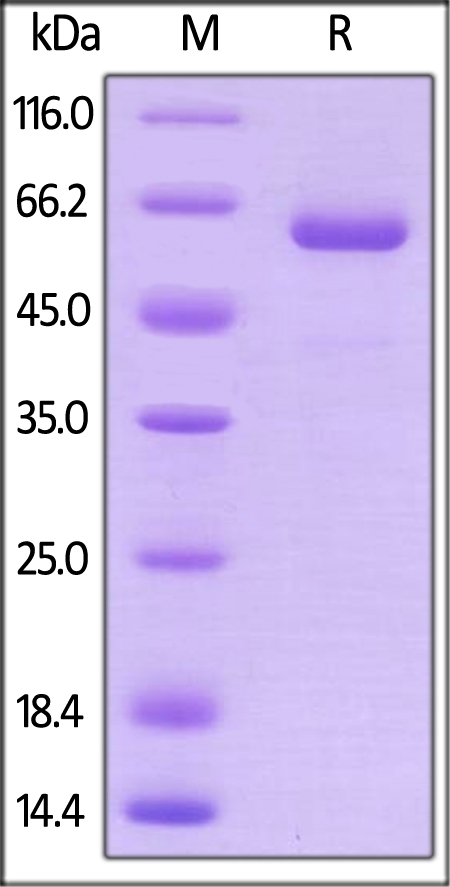 Prolactin R / PRLR Recombinant Protein