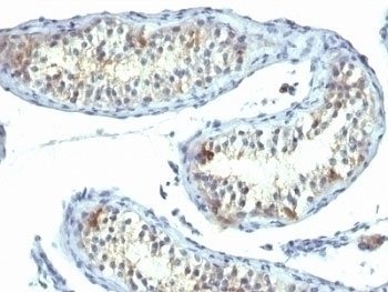 Prolactin Receptor Antibody [B6.2]