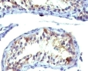 Prolactin Receptor Antibody [ERSV8-1]