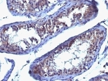 Prolactin Receptor Antibody [SPM213]