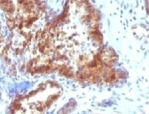 Prostate Specific Antibody [KLK3/1248]