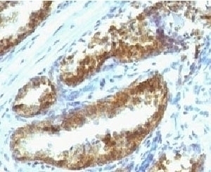 Prostate Specific Antibody [PSAK3-1]