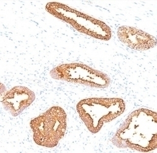 Prostate Specific Antigen Antibody [A67-B/E3]