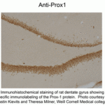 Immunohistochemical staining of rat dentate gyrus showing spcific immunolabeling of the Prox-1 protein.  Photo courtesy of Justin Kievits and Theresa Milner, Weill Cornell Medical college.