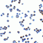 Immunocytochemistry of RAET1E in K562 cells with RAET1E at 2.5 μg/mL.