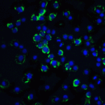 Immunofluorescence of RAIDD in Hela cells with RAIDD antibody at 20 μg/mL.<br><br>Green: RAIDD Antibody (1117) <br> Blue: DAPI staining