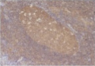 RANTES Antibody [5B3-D5]